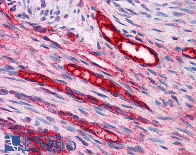 Anti-BUB3 antibody IHC of human uterus, vessels. Immunohistochemistry of formalin-fixed, paraffin-embedded tissue after heat-induced antigen retrieval. Antibody LS-B4858 concentration 10 ug/ml.