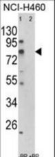 Western blot of ACSS3 Antibody in NCI-H460 cell line lysates (35 ug/lane). ACSS3 (arrow) was detected using the purified antibody.(2 ug/ml)