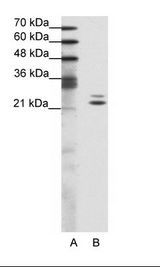 A: Marker, B: Jurkat Cell Lysate