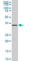 BVES monoclonal antibody (M01), clone 1C3. Western blot of BVES expression in IMR-32.