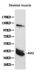 Western blot of BVES pAb in extracts from mouse skeletal muscle tissue.