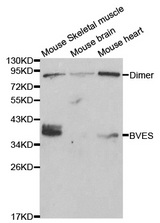 Western blot analysis of extracts of various cell lines, using BVES antibody.