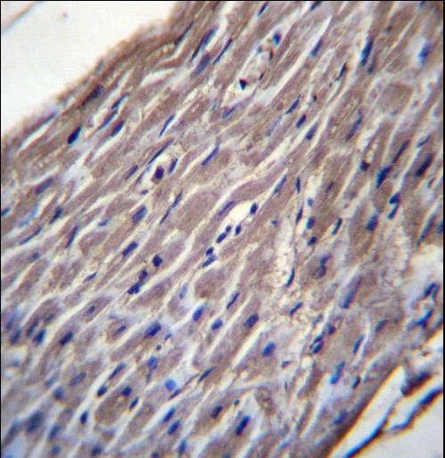 BVES Antibody immunohistochemistry of formalin-fixed and paraffin-embedded human heart tissue followed by peroxidase-conjugated secondary antibody and DAB staining.