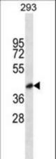 BVES Antibody western blot of 293 cell line lysates (35 ug/lane). The BVES antibody detected the BVES protein (arrow).