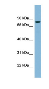 EPB41 antibody LS-C107992 Western blot of Fetal Spleen lysate.