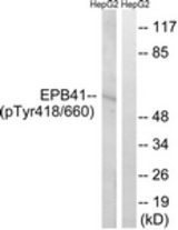 Western blot of extracts from HepG2 cells treated with PMA 125ng/ml 30', using EPB41 (Phospho-Tyr660/418) Antibody. The lane on the right was incubated with synthetic peptide.