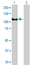 Western blot of EPB41 expression in transfected 293T cell line by EPB41 monoclonal antibody (M01), clone 3D9.