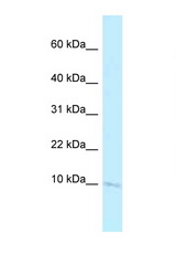 Banf2 antibody LS-C146108 Western blot of Small Intestine lysate. Antibody concentration 1 ug/ml.