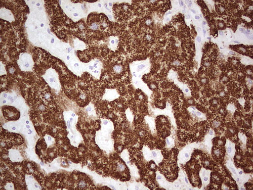 IHC of paraffin-embedded Human liver tissue using anti-ABAT mouse monoclonal antibody. (Heat-induced epitope retrieval by 1 mM EDTA in 10mM Tris, pH8.5, 120°C for 3min).