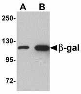 Western blot of (A) 5 and (B) 25 ng of b-gal with b-gal antibody at 1 ug/ml.