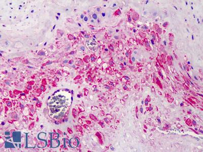 Anti-COPB2 antibody IHC of human placenta. Immunohistochemistry of formalin-fixed, paraffin-embedded tissue after heat-induced antigen retrieval. Antibody LS-B2677 concentration 5 ug/ml.