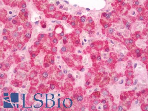Human Liver: Formalin-Fixed, Paraffin-Embedded (FFPE)