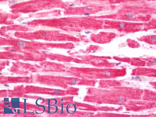 Human Heart: Formalin-Fixed, Paraffin-Embedded (FFPE)