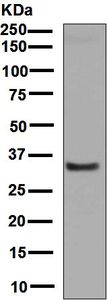 Western blot analysis on human plasma lysate using anti-Alpha-1-Microglobulin antibody.