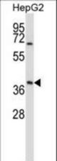 AMBP Antibody western blot of HepG2 cell line lysates (35 ug/lane). The AMBP antibody detected the AMBP protein (arrow).