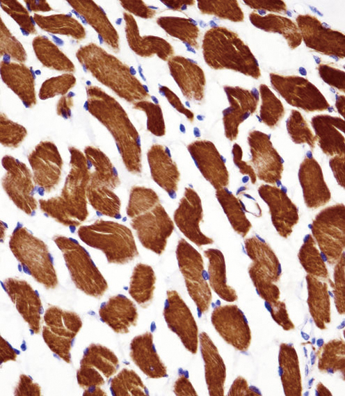ACTA1/ alpha -actin Antibody immunohistochemistry of formalin-fixed and paraffin-embedded human skeletal muscle followed by peroxidase-conjugated secondary antibody and DAB staining.This data demonstrates the use of ACTA1/ alpha -actin Antibody for immunohistochemistry.