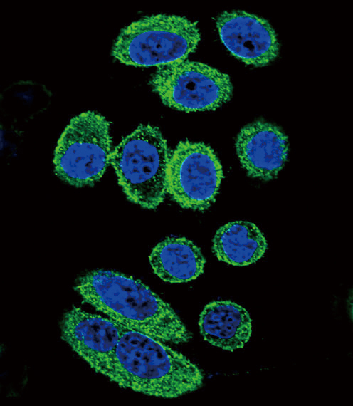 Confocal immunofluorescent of ACTA1/ alpha -actin Antibody with A549 cell followed by Alexa Fluor 488-conjugated goat anti-rabbit lgG (green). DAPI was used to stain the cell nuclear (blue).