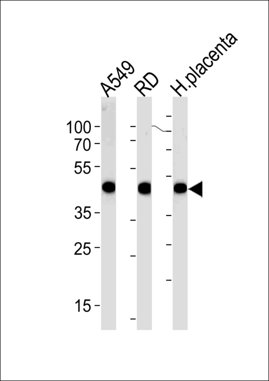 ACTA1/ alpha -actin Antibody western blot of A549,RD cell line and human placenta lysates (35 ug/lane). The ACTA1/ alpha -actin antibody detected the ACTA1/ alpha -actin protein (arrow).