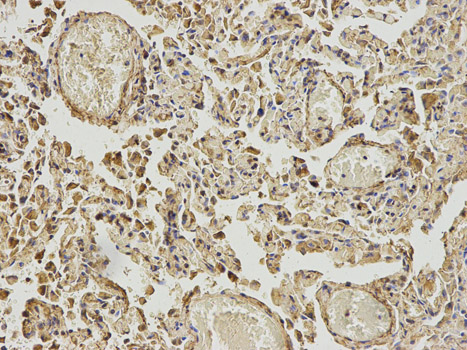 Immunohistochemistry of paraffin-embedded human lung using ABAT antibody at dilution of 1:200 (200x lens).