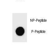 Dot blot of Phospho-KIT-S746 Antibody Phospho-specific antibody on nitrocellulose membrane. 50ng of Phospho-peptide or Non Phospho-peptide per dot were adsorbed. Antibody working concentrations are 0.6ug per ml.