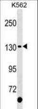 KIT Antibody (C-term Y900)western blot of K562 cell line lysates (35 ug/lane). The KIT antibody detected the KIT protein (arrow).