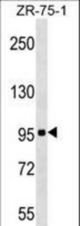 KIT Antibody (Center S713) western blot of ZR-75-1 cell line lysates (35 ug/lane). The KIT antibody detected the KIT protein (arrow).