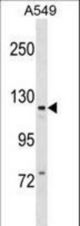 KIT Antibody (Center T354)western blot of A549 cell line lysates (35 ug/lane). The KIT antibody detected the KIT protein (arrow).