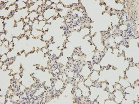 Immunohistochemistry of paraffin-embedded mouse lung using ABAT antibody at dilution of 1:200 (200x lens).