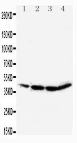 WB of C/EBP Alpha / CEBPA antibody. All lanes: Anti-CEBPA at 0.5ug/ml. Lane 1: MM231 Whole Cell Lysate at 40ug. Lane 2: JURKAT Whole Cell Lysate at 40ug. Lane 3: RAJI Whole Cell Lysate at 40ug. Lane 4: HELA Whole Cell Lysate at 40ug. Predicted bind size: 37KD. Observed bind size: 37KD.