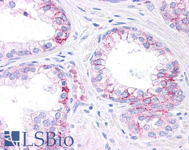 Anti-CEBPA / CEBP Alpha antibody IHC of human prostate. Immunohistochemistry of formalin-fixed, paraffin-embedded tissue after heat-induced antigen retrieval. Antibody LS-B4685 concentration 5 ug/ml.