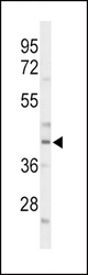 Western blot of CEBPA Antibody in mouse liver tissue lysates (35 ug/lane). CEBPA (arrow) was detected using the purified antibody.