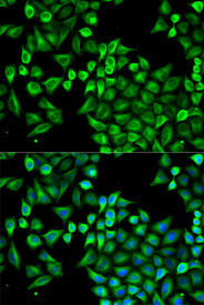 Immunofluorescence analysis of A549 cell using ABAT antibody. Blue: DAPI for nuclear staining.