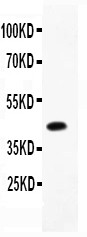 CEBP Beta antibody Western blot. All lanes: Anti CEBP Beta at 0.5 ug/ml. WB: Recombinant Human CEBP Beta Protein 0.5ng. Predicted band size: 42 kD. Observed band size: 42 kD.