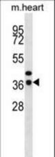 CEBPE Antibody western blot of mouse heart tissue lysates (35 ug/lane). The CEBPE antibody detected the CEBPE protein (arrow).