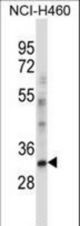 CEBPE Antibody western blot of NCI-H460 cell line lysates (35 ug/lane). The CEBPE antibody detected the CEBPE protein (arrow).