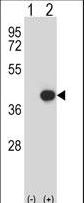 Western blot of CEBPE (arrow) using rabbit polyclonal CEBPE Antibody. 293 cell lysates (2 ug/lane) either nontransfected (Lane 1) or transiently transfected (Lane 2) with the CEBPE gene.