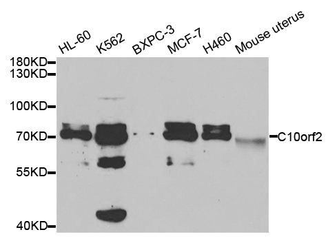 Western blot analysis of extracts of various cell lines, using C10orf2 antibody.