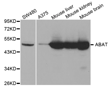 Western blot analysis of extracts of various cell lines, using ABAT antibody.