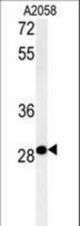 C11orf46 Antibody western blot of A2058 cell line lysates (35 ug/lane). The C11orf46 antibody detected the C11orf46 protein (arrow).