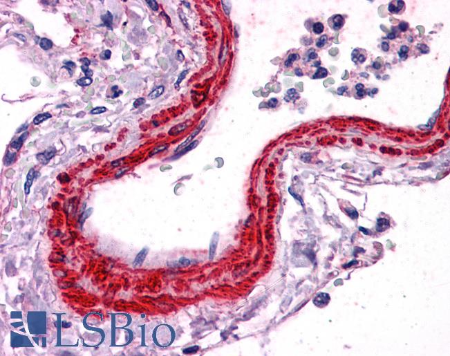 Anti-ACTA2 antibody IHC of human vessel. Immunohistochemistry of formalin-fixed, paraffin-embedded tissue after heat-induced antigen retrieval. Antibody LS-B3933 concentration 2.5 ug/ml.