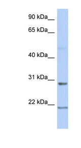 C12orf53 antibody LS-C111492 Western blot of Fetal Spleen lysate.