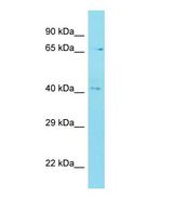 Western blot of C12orf56 Antibody - N-terminal region with human MDA-MB-435S cells lysate.