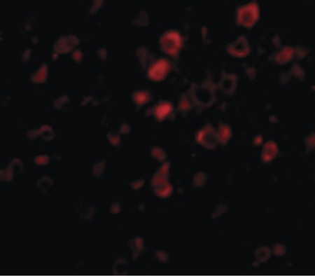 Immunofluorescence of Bora in Mouse Brain cells with Bora antibody at 20 ug/ml.