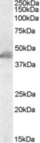 Antibody staining (0.1 ug/ml) of Human Duodenum lysate (RIPA buffer, 35 ug total protein per lane). Primary incubated for 1 hour. Detected by Western blot of chemiluminescence.