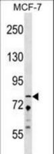 ZNF828 Antibody western blot of MCF-7 cell line lysates (35 ug/lane). The ZNF828 antibody detected the ZNF828 protein (arrow).