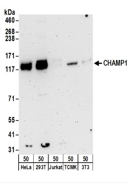 Detection of Human and Mouse CHAMP1 by Western Blot. Samples: Whole cell lysate (50 ug) from HeLa, 293T, Jurkat, mouse TCMK-1, and mouse NIH3T3 cells. Antibodies: Affinity purified rabbit anti-CHAMP1 antibody used for WB at 0.1 ug/ml. Detection: Chemiluminescence with an exposure time of 3 minutes.
