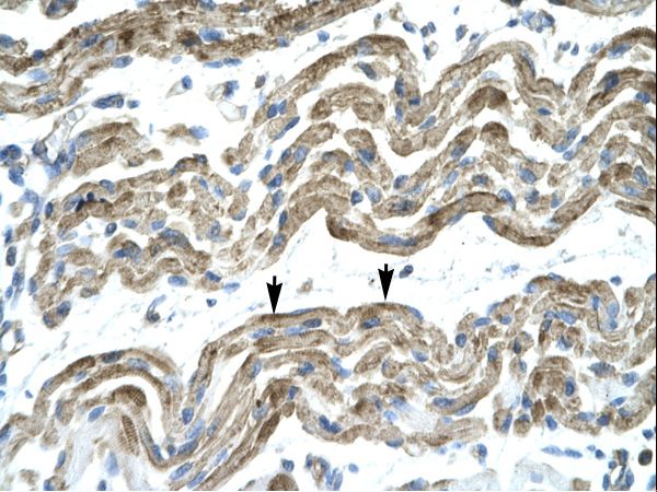 ZNF828 / C13orf8 antibody LS-C31428 was used in IHC to stain formalin-fixed, paraffin-embedded human muscle.
