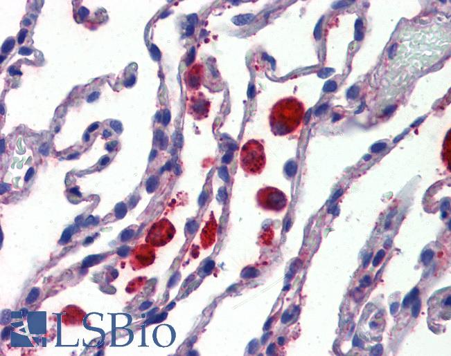 Anti-C14orf1 antibody LS-A9920 IHC of human lung. Immunohistochemistry of formalin-fixed, paraffin-embedded tissue after heat-induced antigen retrieval.