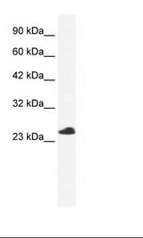Jurkat Cell Lysate