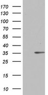 HEK293T cells were transfected with the pCMV6-ENTRY control (Left lane) or pCMV6-ENTRY C14orf166 (Right lane) cDNA for 48 hrs and lysed. Equivalent amounts of cell lysates (5 ug per lane) were separated by SDS-PAGE and immunoblotted with anti-C14orf166.